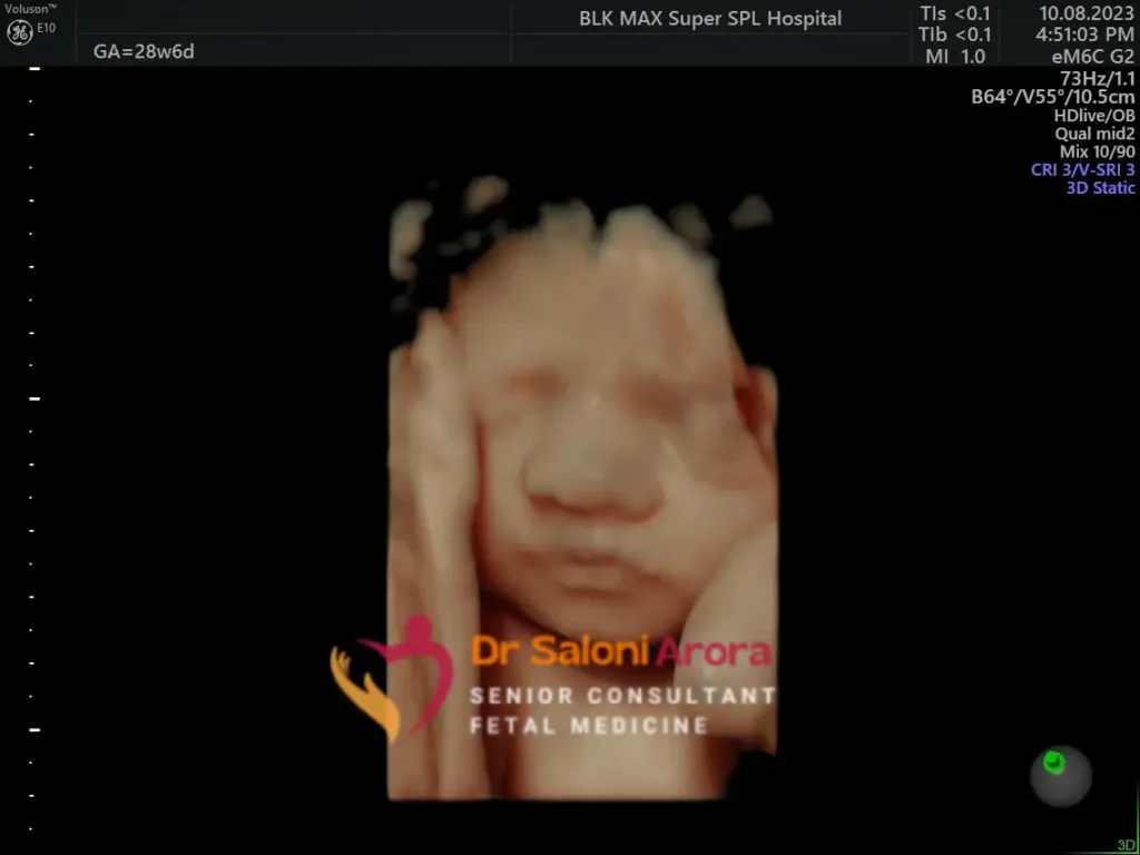3d/ 4d Ultrasound Scan