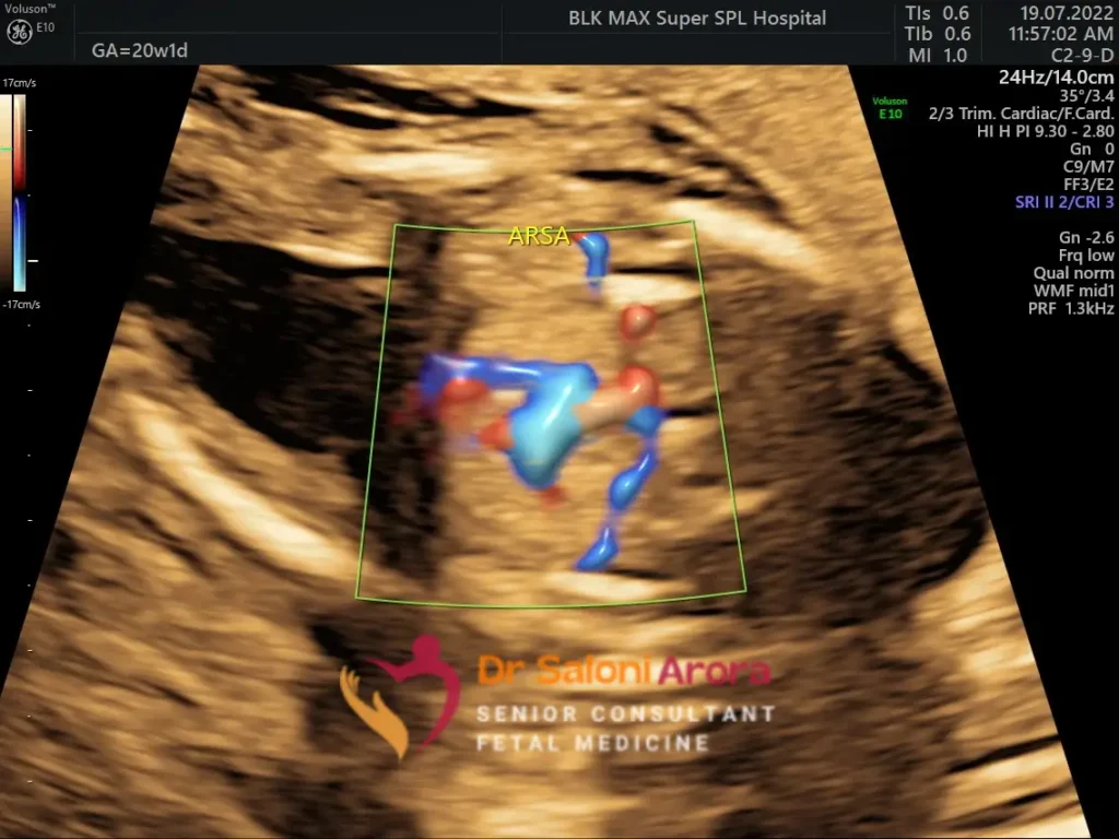 Genetic Sonogram