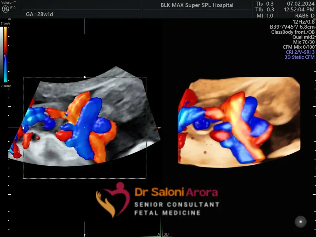 Fetal Well Being Scan