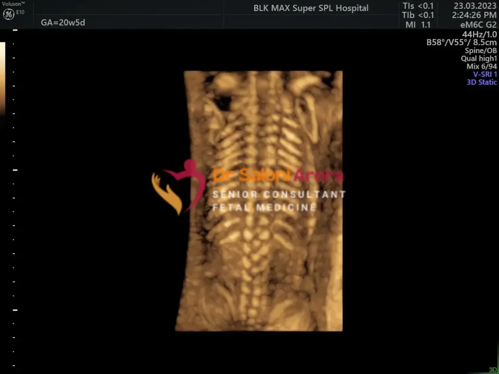 Detailed Anomaly Scan