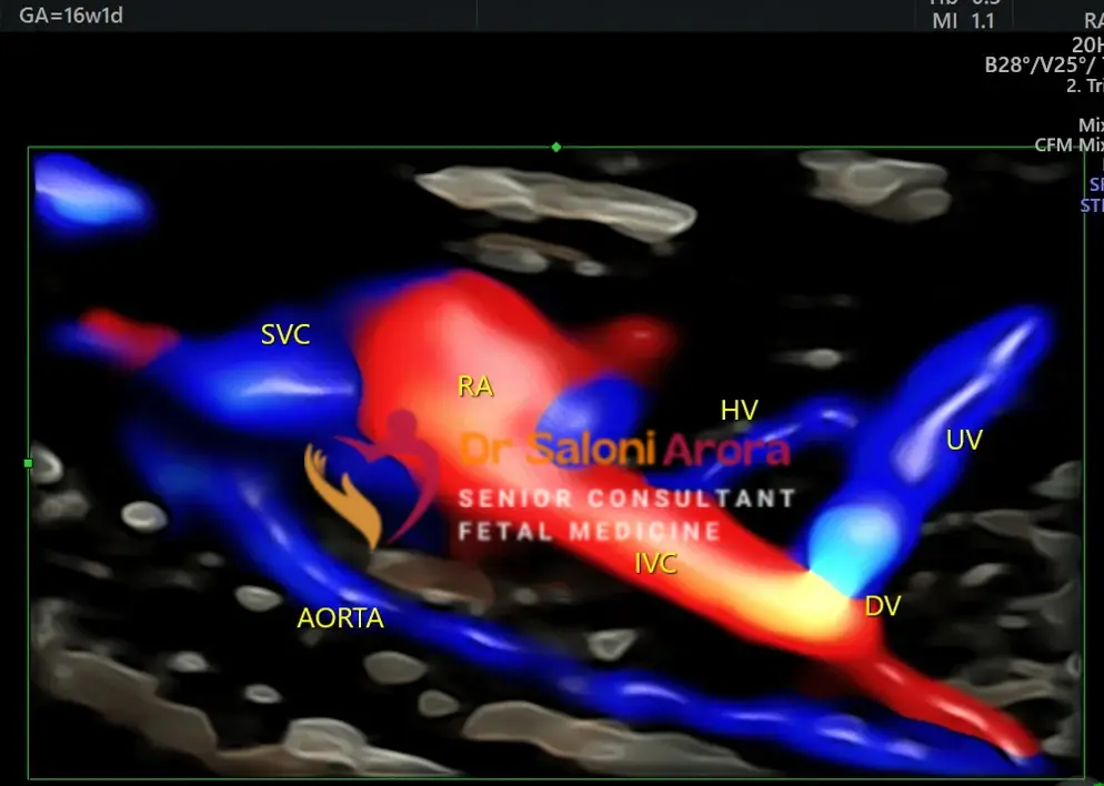 Early Anomaly Scan